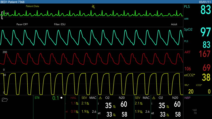 A fictional hospital computer screen monitoring a human heart.  100% loopable!