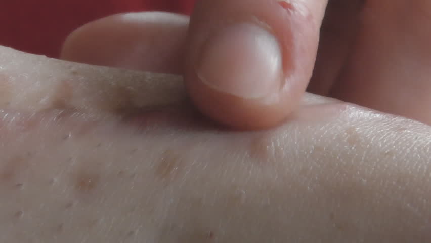 Header of Scar