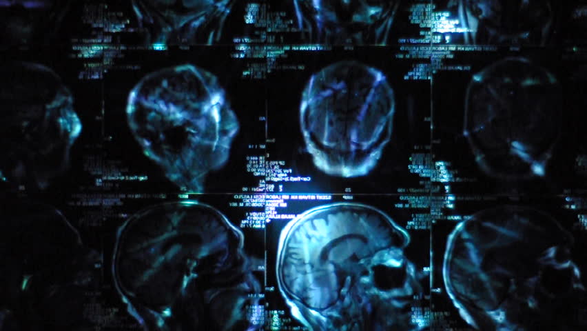Computer topography scan with flourish ( CT Scan )
