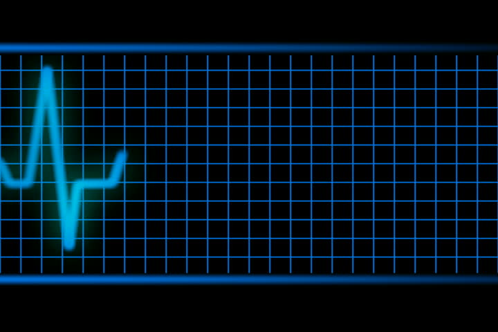 Blue EKG Machine NTSC seamless loopable