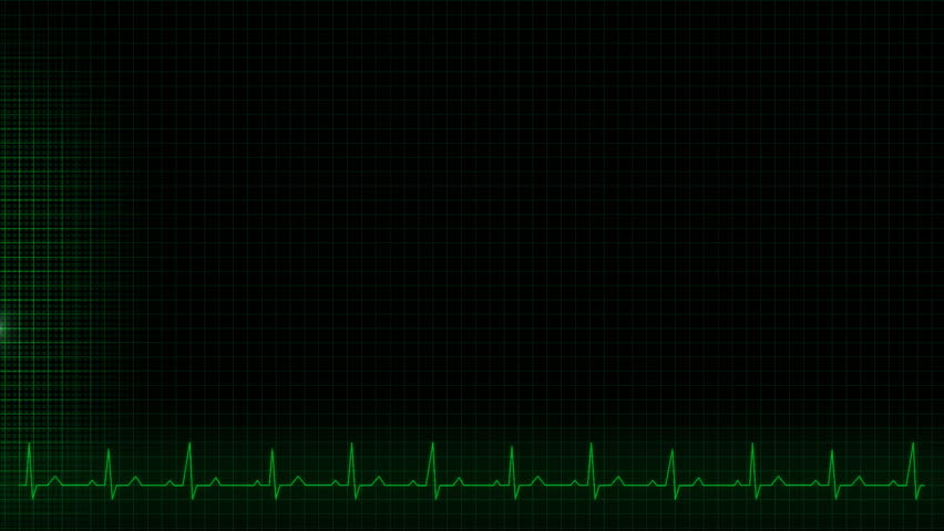 Illustration of a heartbeat impulse line 