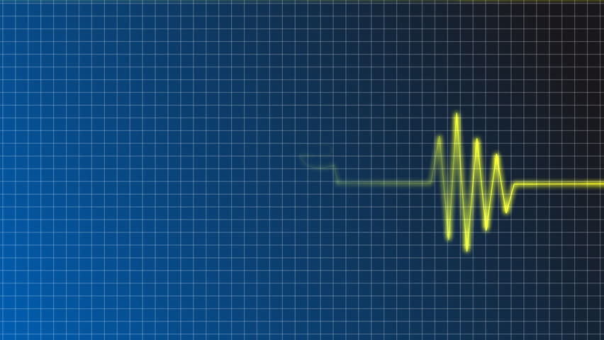 cardiogram curve with euro symbol