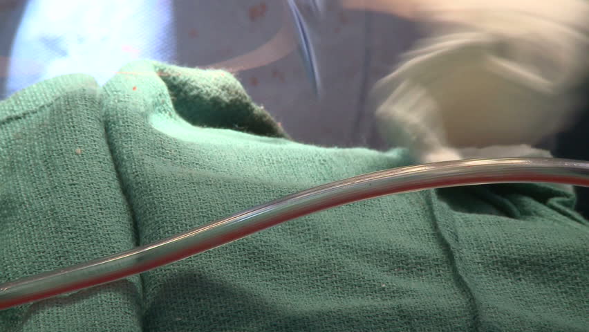 Side view of surgeon stitching patient