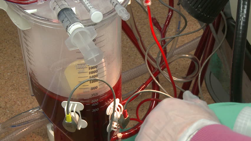 Closeup of heart lung bypass machine (2 of 2)