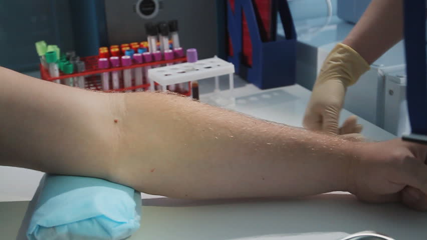 Blood draw. Donor. To draw a hand a plait, to stop a blood-groove.