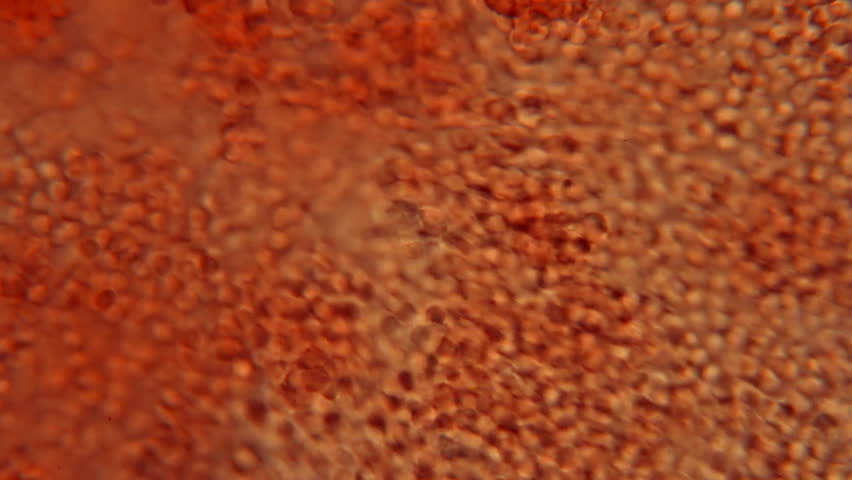 Blood Torrent Microscope View. Blood torrent from pathology sample at 250x magnification.