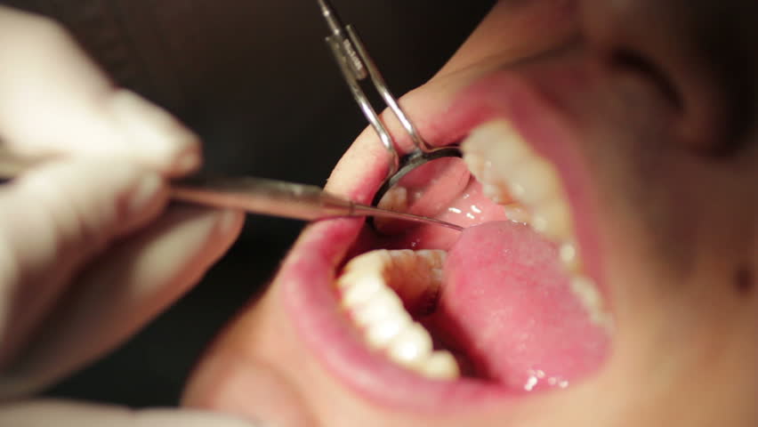 Close-up of patient open mouth during oral checkup