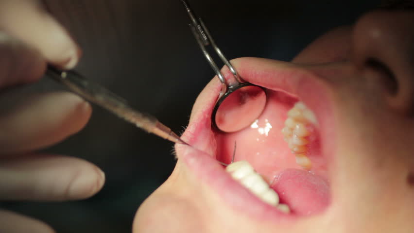 Close-up of patient open mouth during oral checkup