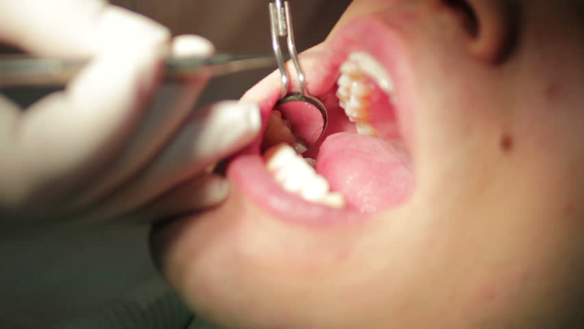 Close-up of patient open mouth during oral checkup