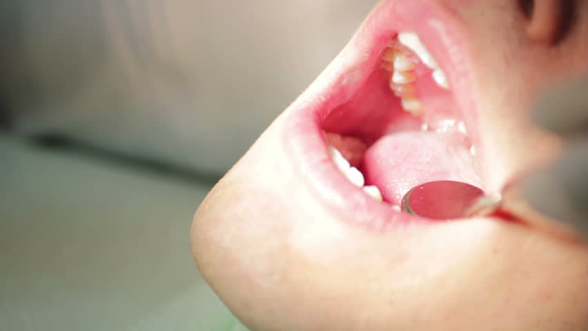 Close-up of patient open mouth during oral checkup