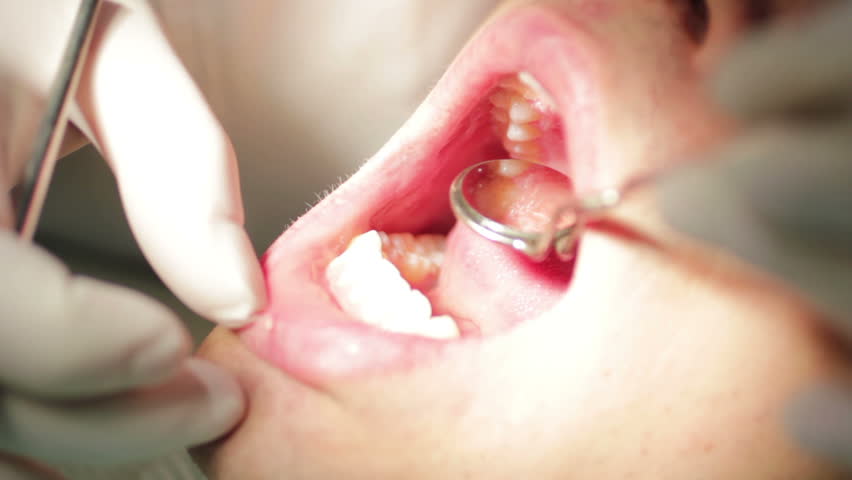 Close-up of patient open mouth during oral checkup