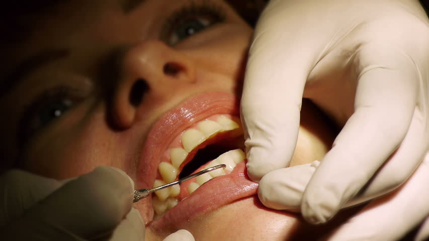 Dental Checkup (HD). Dentist cleaning teeth and checking with plaque remover tool & angled mirror. 