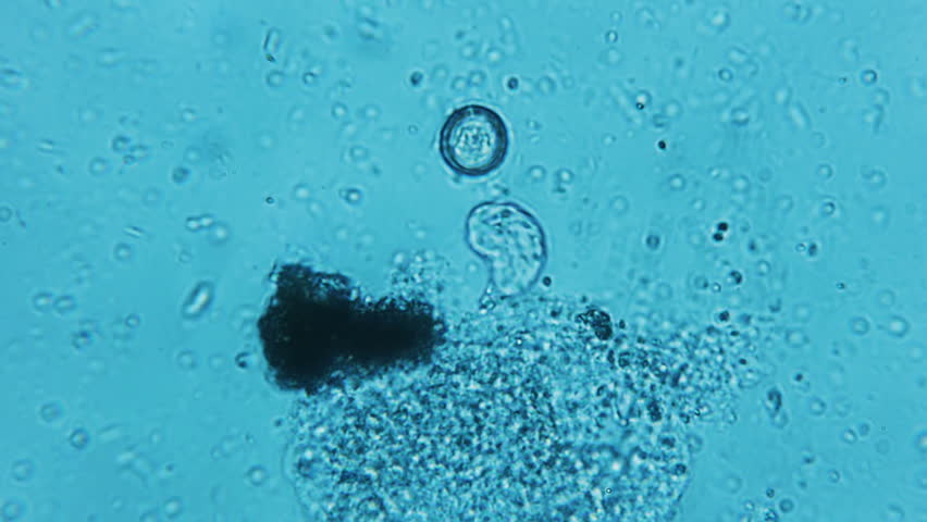 Decomposing Flesh With Bacteria  - Microscope view