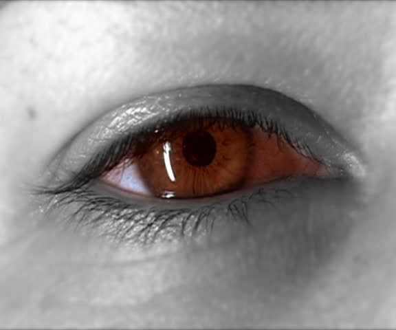 Female red eye looks up, left right and down. Redness resembles pink eyes.