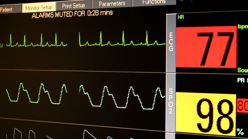 Hospital monitor displays patient vital signs. 1080p