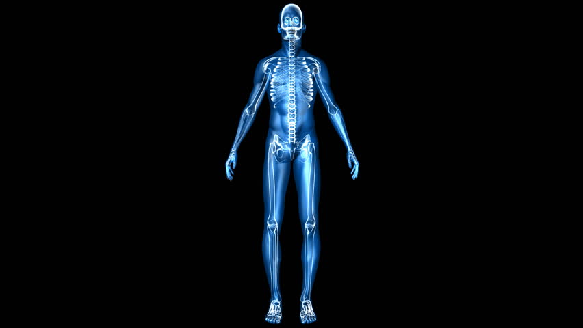 Back pain