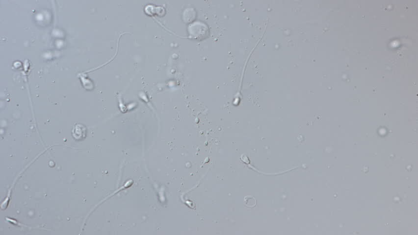 sperm no Pregnancy vasectomy count after Rosario recommend Glacial facial clay masks vancouver