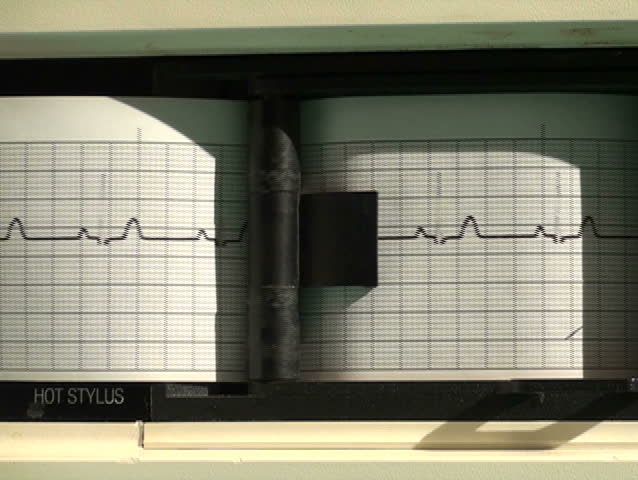 EKG printer close-up flat line - NTSC