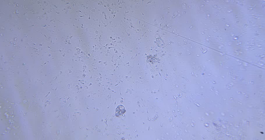 Header of semen