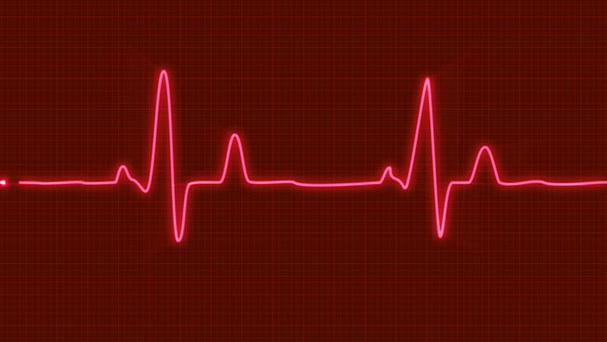 Looped Animated Ecg Electrocardiogram Display. Stock Footage Video (100