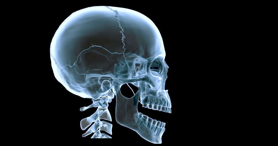 Stock video of an animated x ray of a | 29512549 | Shutterstock