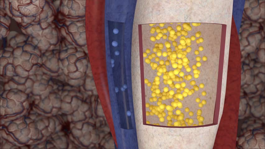 anatomical, physiological and alveoli dead space