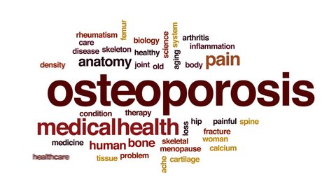 Osteoporosis State Animated Word Cloud Text Stock Footage Video (100% Royalty-free) 30727909 | Shutterstock Osteoporosis State Animated Word Cloud Text Stock Footage Video (100% Royalty-free) 30727909 | Shutterstock