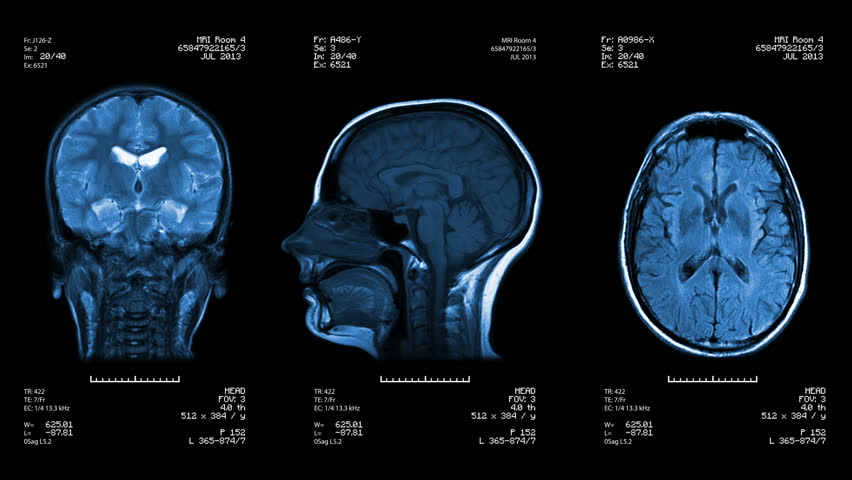Three head views of MRI scan. Loopable. Blue.
See more color options in my portfolio.