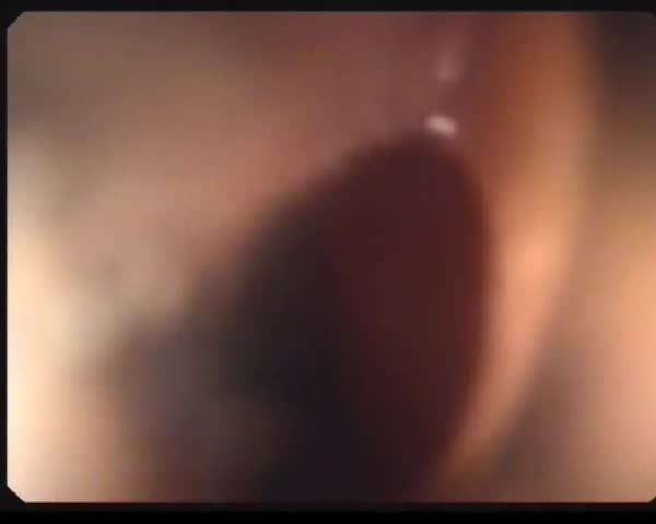 Header of endoscopy
