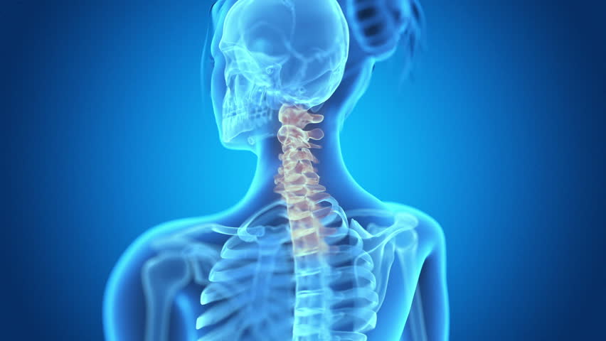 x-ray style - medical 3d animation of a female having acute pain in the neck