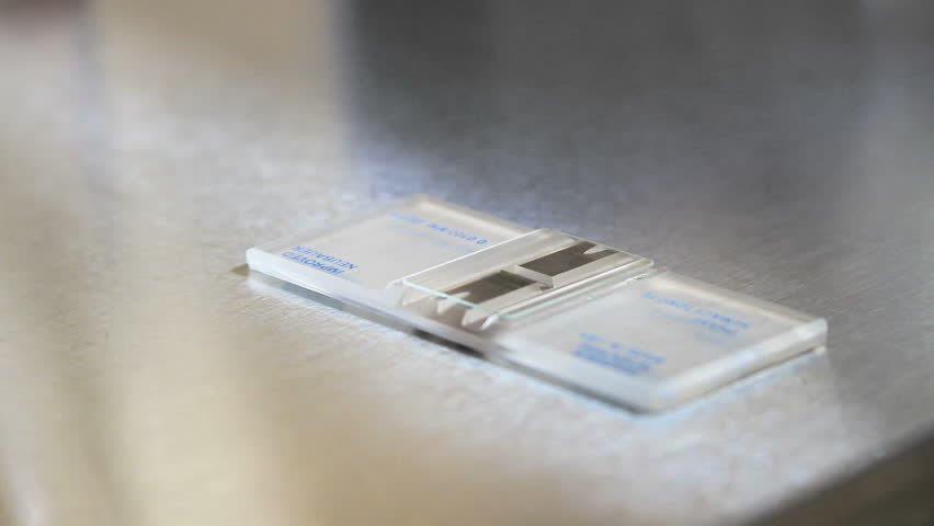 Header of hemocytometer